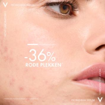 Vichy Normaderm Probio BHA Serum Anti-Onzuiverheden 30ml